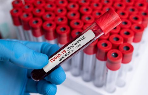 Doctor with blood sample of Covid-19 Omicron B.1.1.529 Variant and general data of covid-19 Coronavirus Mutations.