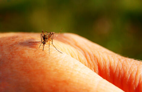 A mosquito biting a person's hand.