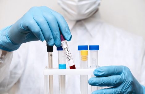 Monkeypox lab image